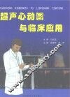 超声心动图与临床应用