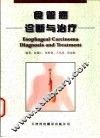 食管癌诊断与治疗