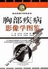 胸部疾病影像学图鉴
