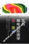 实用脑电地形图学彩色图谱