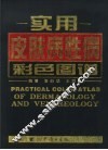 实用皮肤病性病彩色图谱
