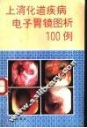 上消化道疾病电子胃镜图析100例