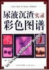 尿液沉渣实录彩色图谱