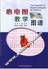 心电图教学图谱