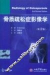 骨质疏松症影像学