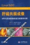 肝磁共振成像MRI与其他影像检查及病理学对照